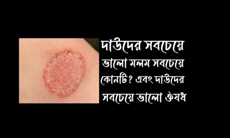 দাউদের সবচেয়ে ভালো মলম ২০২৪
